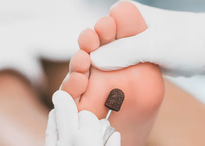 Podiatry Treatments Medical Pedicure