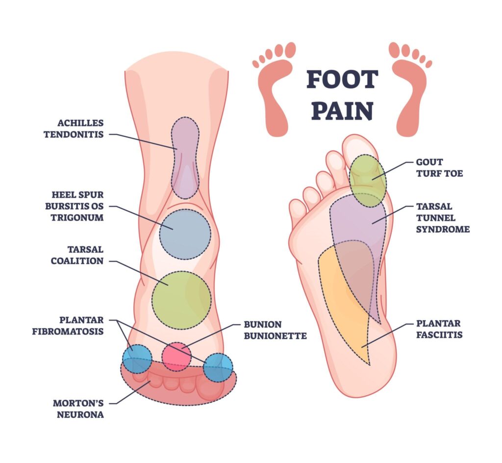 foot pain treatment