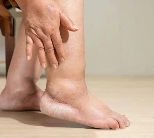 diabetic foot care daily check