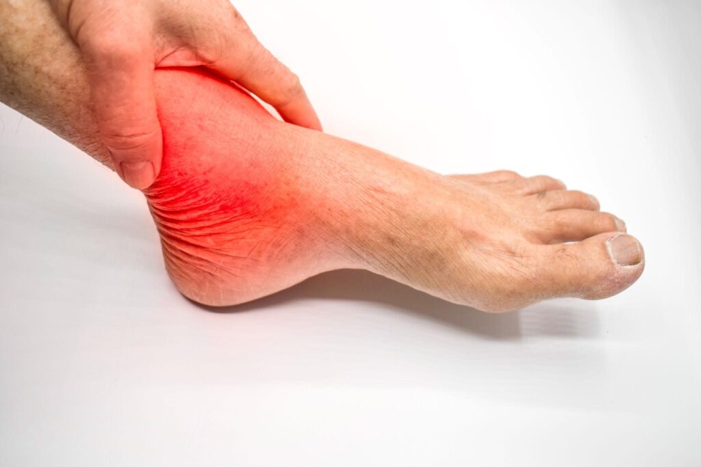 ankle pain treatment swelling relief